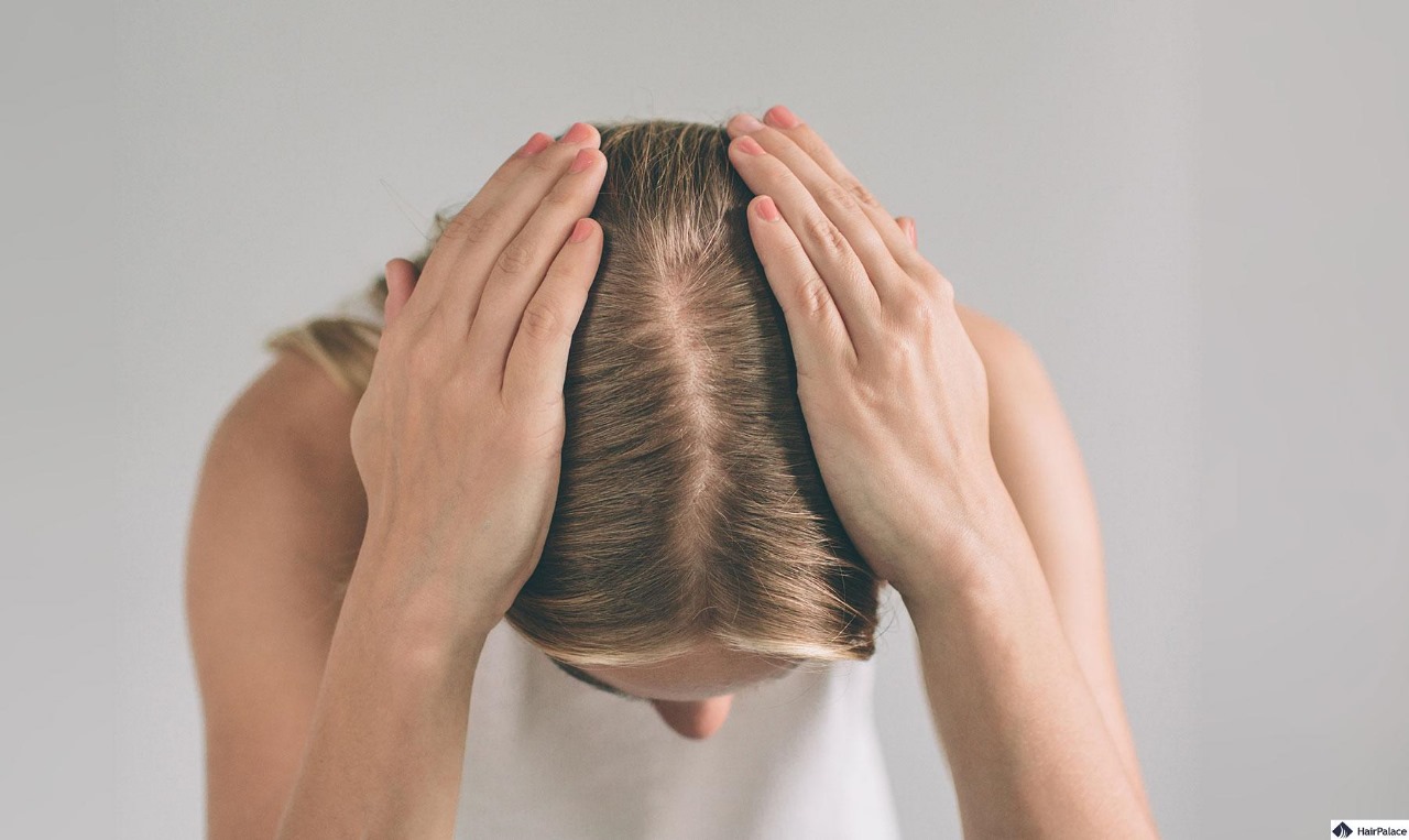 Hair Transplant London – From Consultation to Full Recovery
