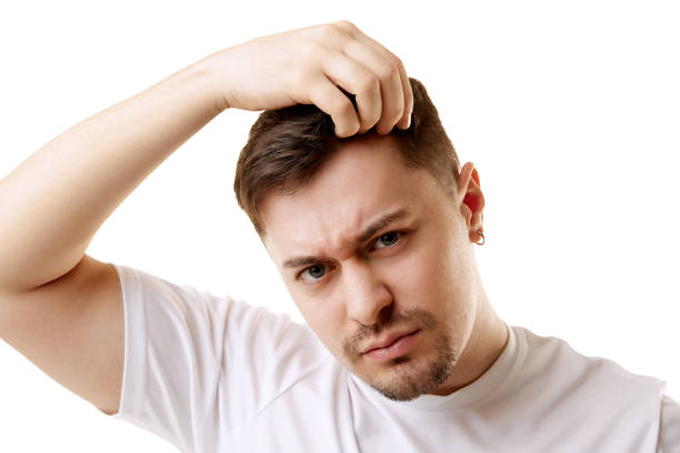 Hair Transplant Turkey Cost in Istanbul: What You Should Expect